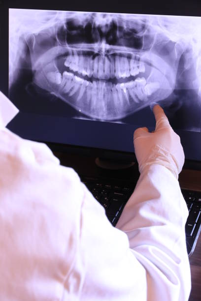 Best Emergency Treatment for Dental Infections or Abscesses in Byhalia, MS